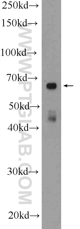 WB analysis of SKOV-3 using 16812-1-AP