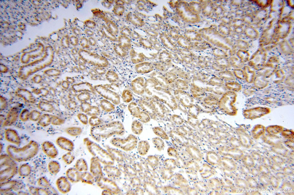 IHC staining of human kidney using 16249-1-AP