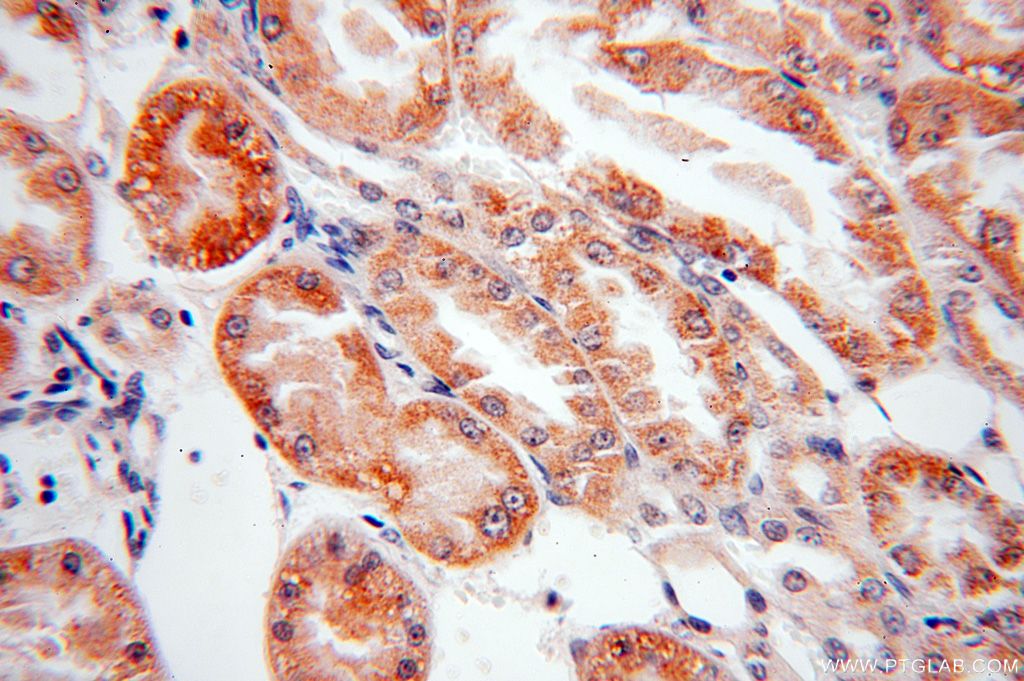 IHC staining of human kidney using 16249-1-AP