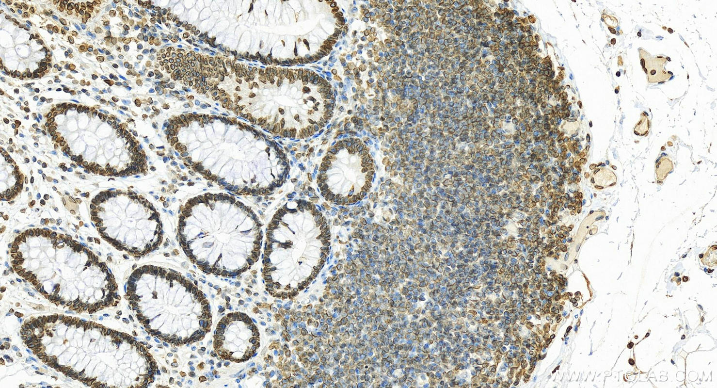 IHC staining of human normal colon using 12987-1-AP