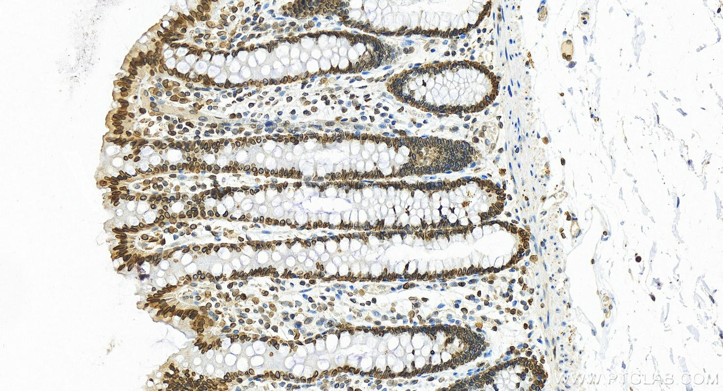 IHC staining of human normal colon using 12987-1-AP