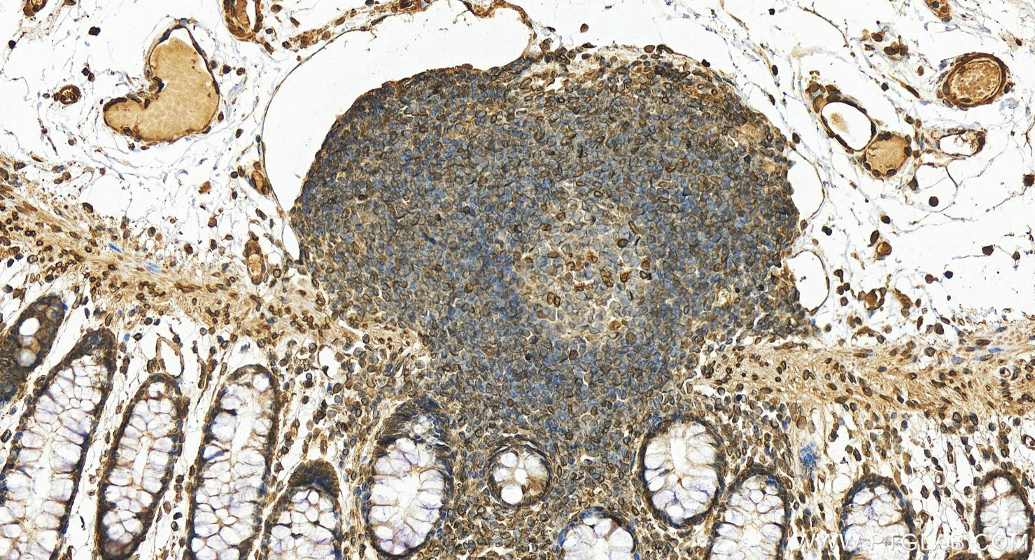 IHC staining of human colon using 10895-1-AP