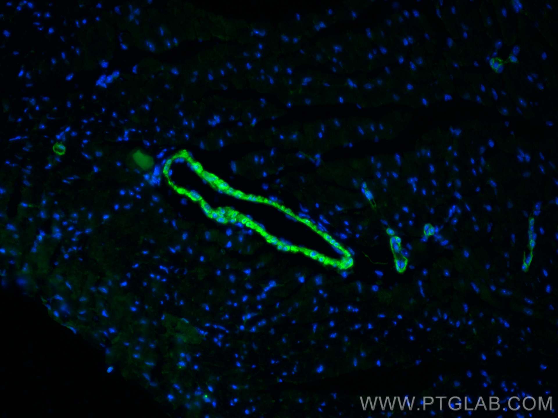 IF Staining of mouse heart using 15117-1-AP