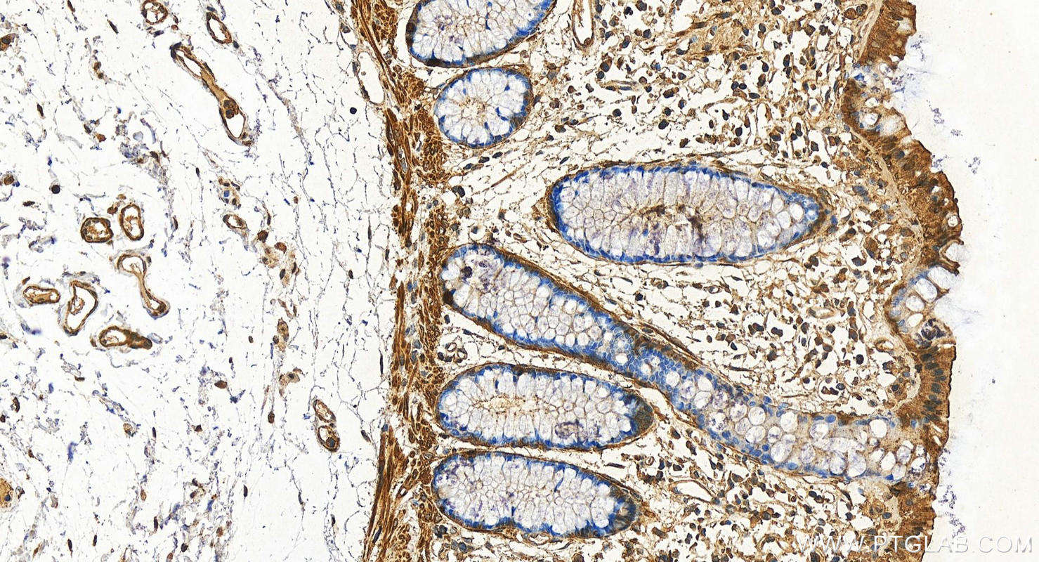 IHC staining of human colon using 60414-1-Ig