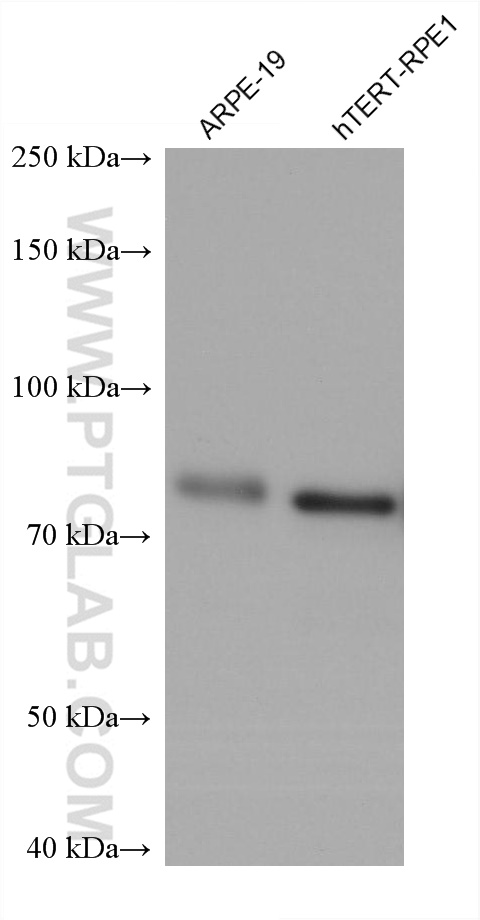 WB analysis using 60414-1-Ig