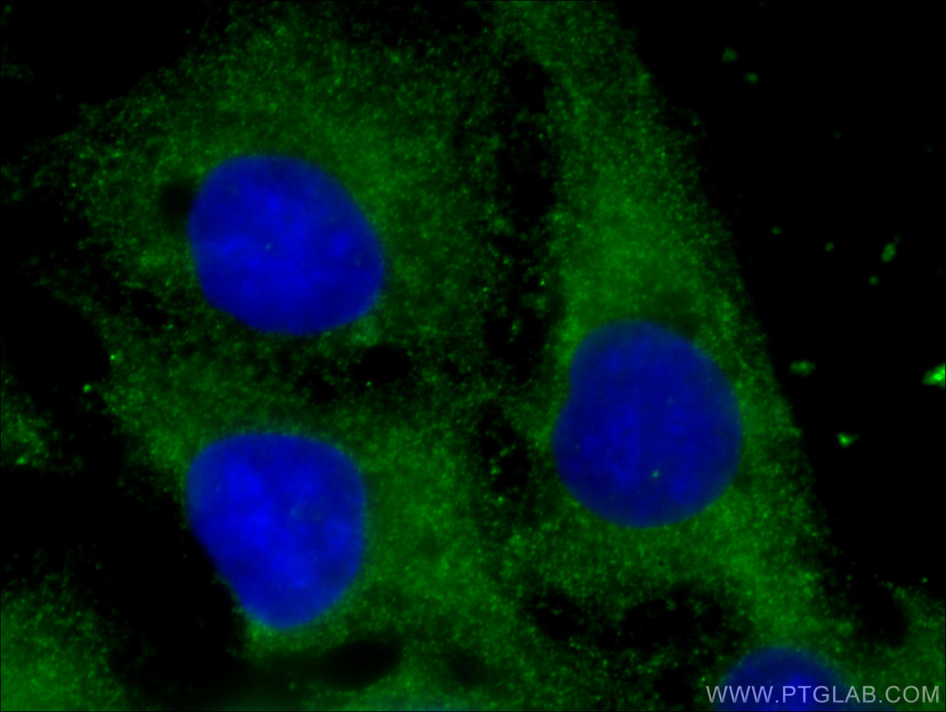 IF Staining of U2OS using 17169-1-AP