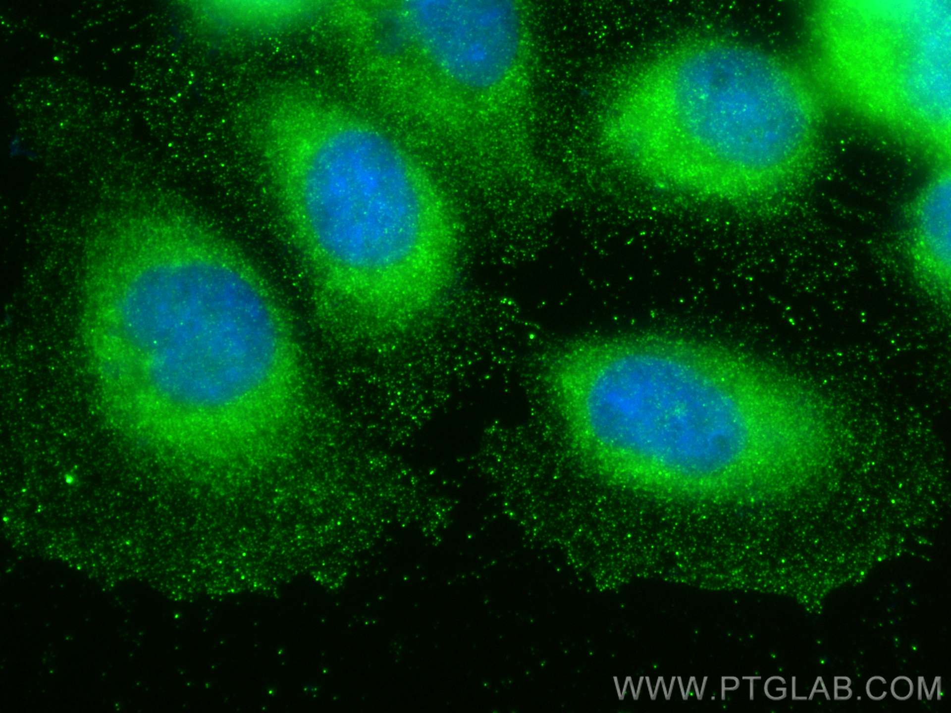 IF Staining of A431 using 55439-1-AP