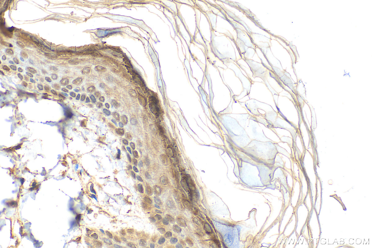 IHC staining of rat skin using 55439-1-AP