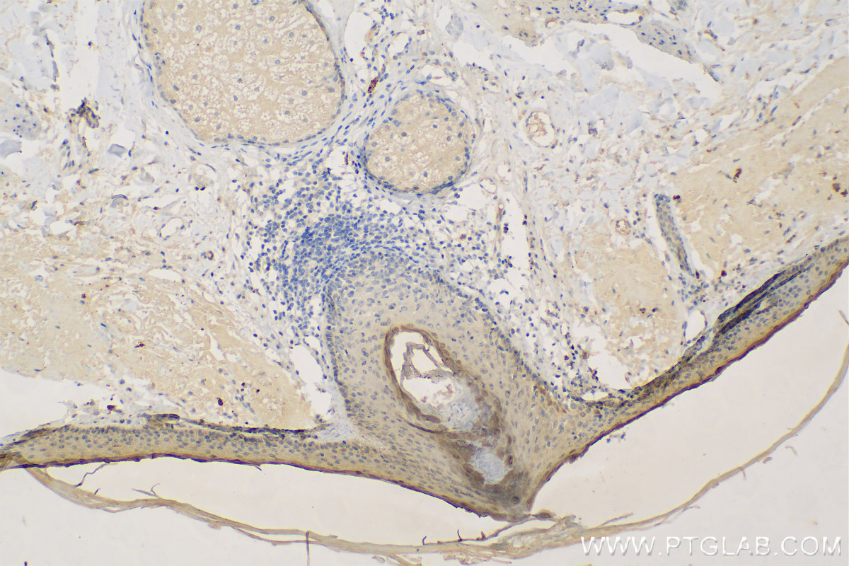 IHC staining of human paracancerous tissue of skin using 55439-1-AP