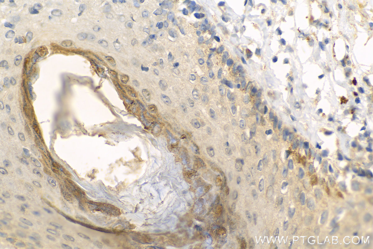 IHC staining of human paracancerous tissue of skin using 55439-1-AP