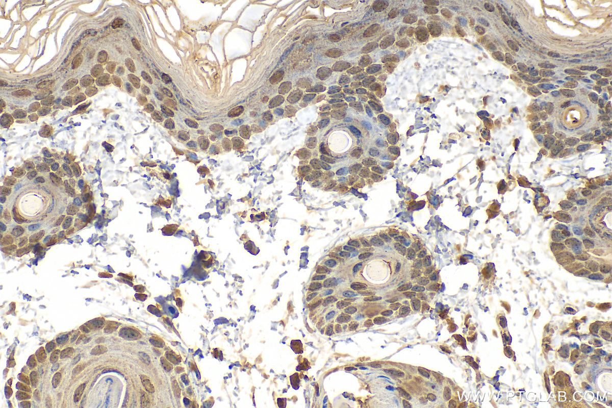 IHC staining of mouse skin using 55439-1-AP