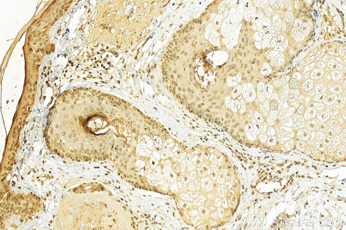 IHC staining of human paracancerous using 55439-1-AP