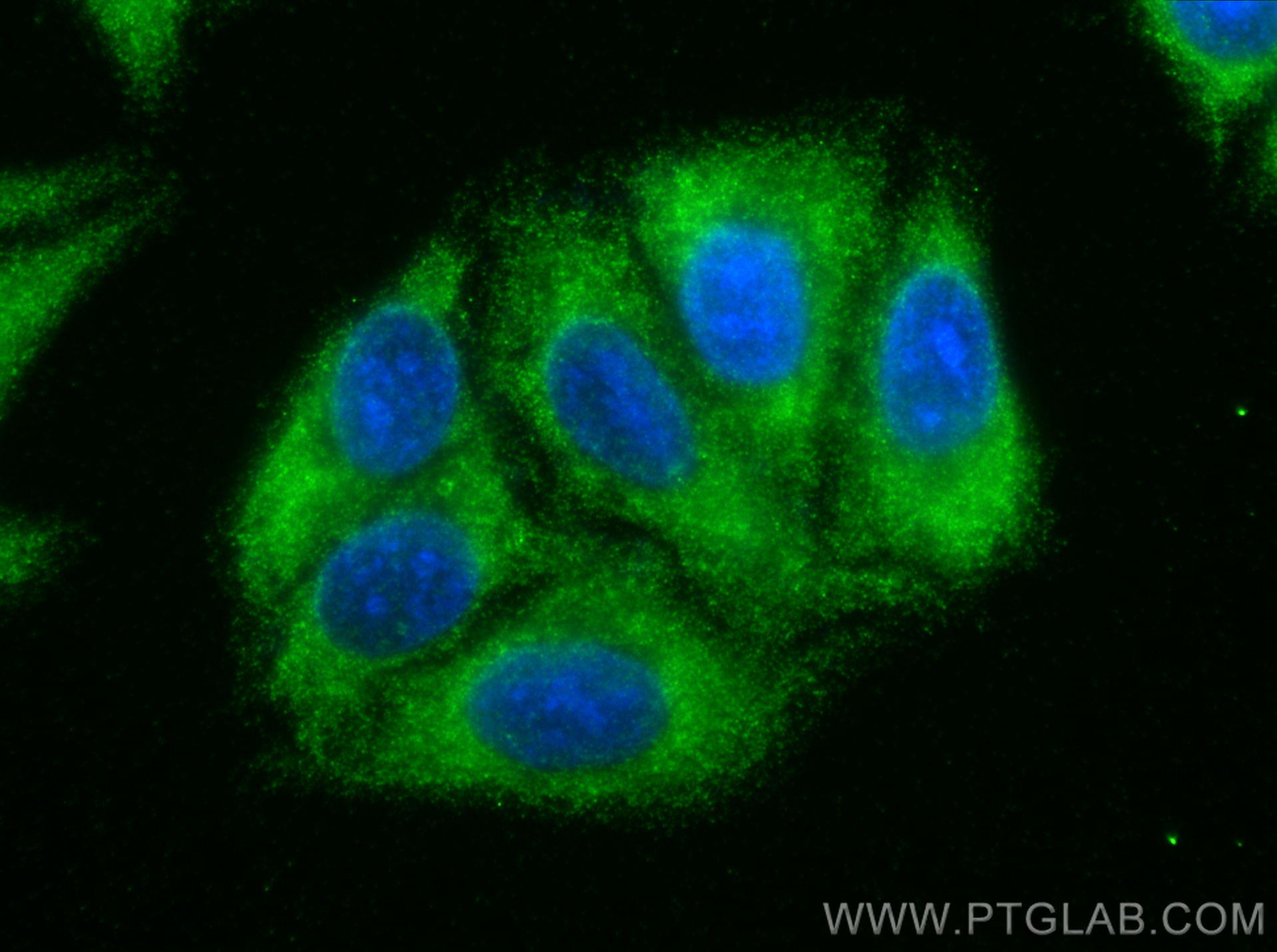 IF Staining of HepG2 using 15232-1-AP