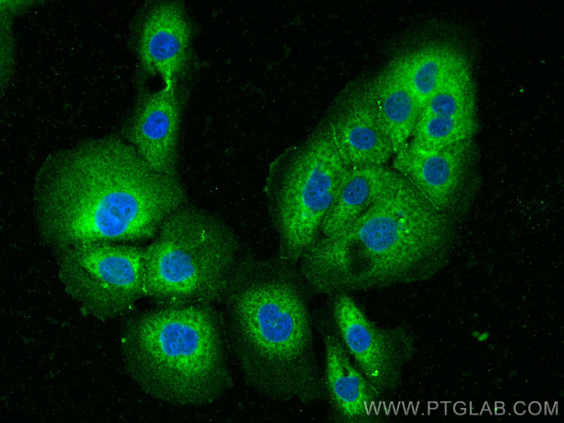 IF Staining of SW 1990 using 22165-1-AP