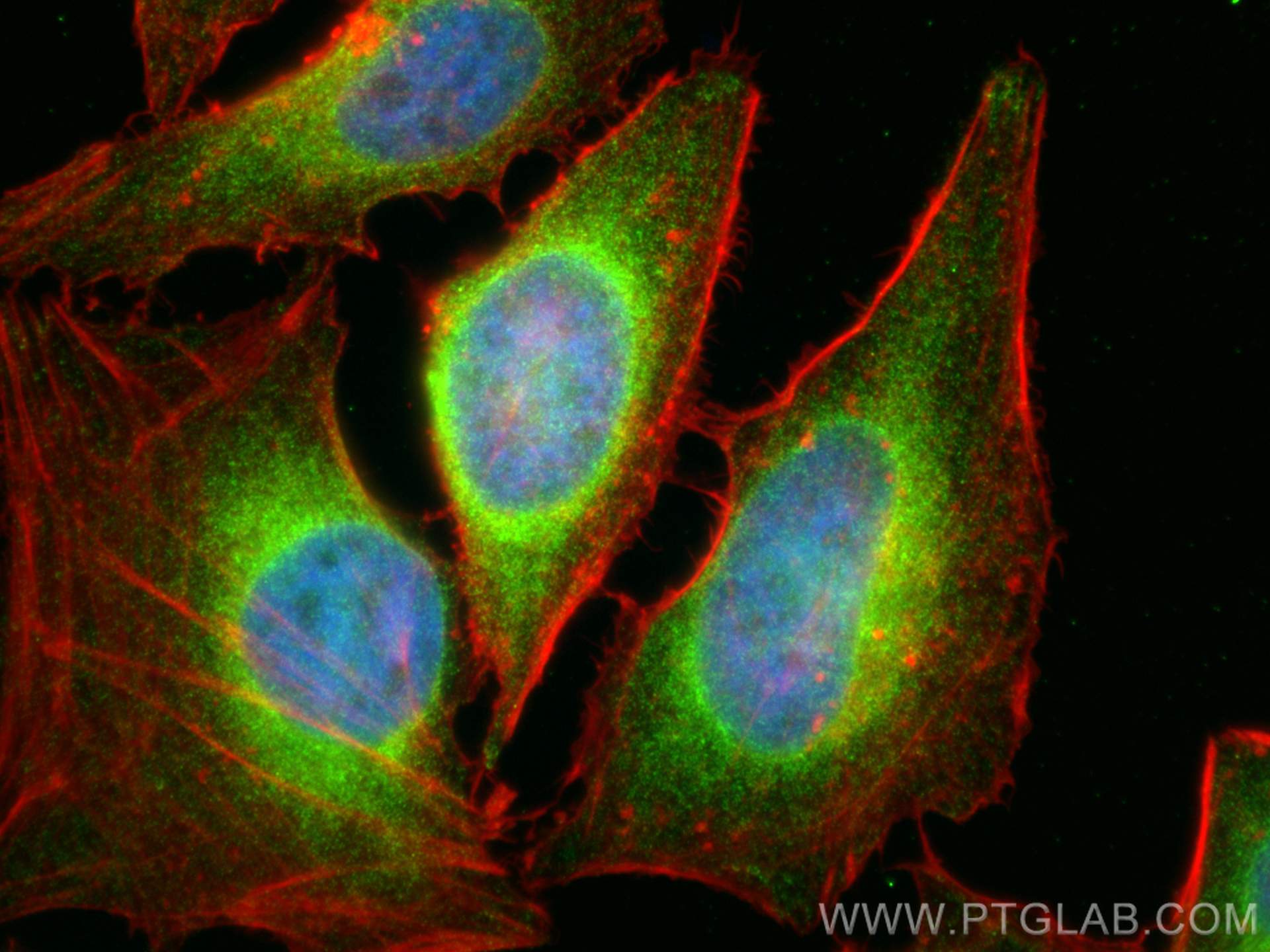 IF Staining of HeLa using 66044-1-Ig (same clone as 66044-1-PBS)