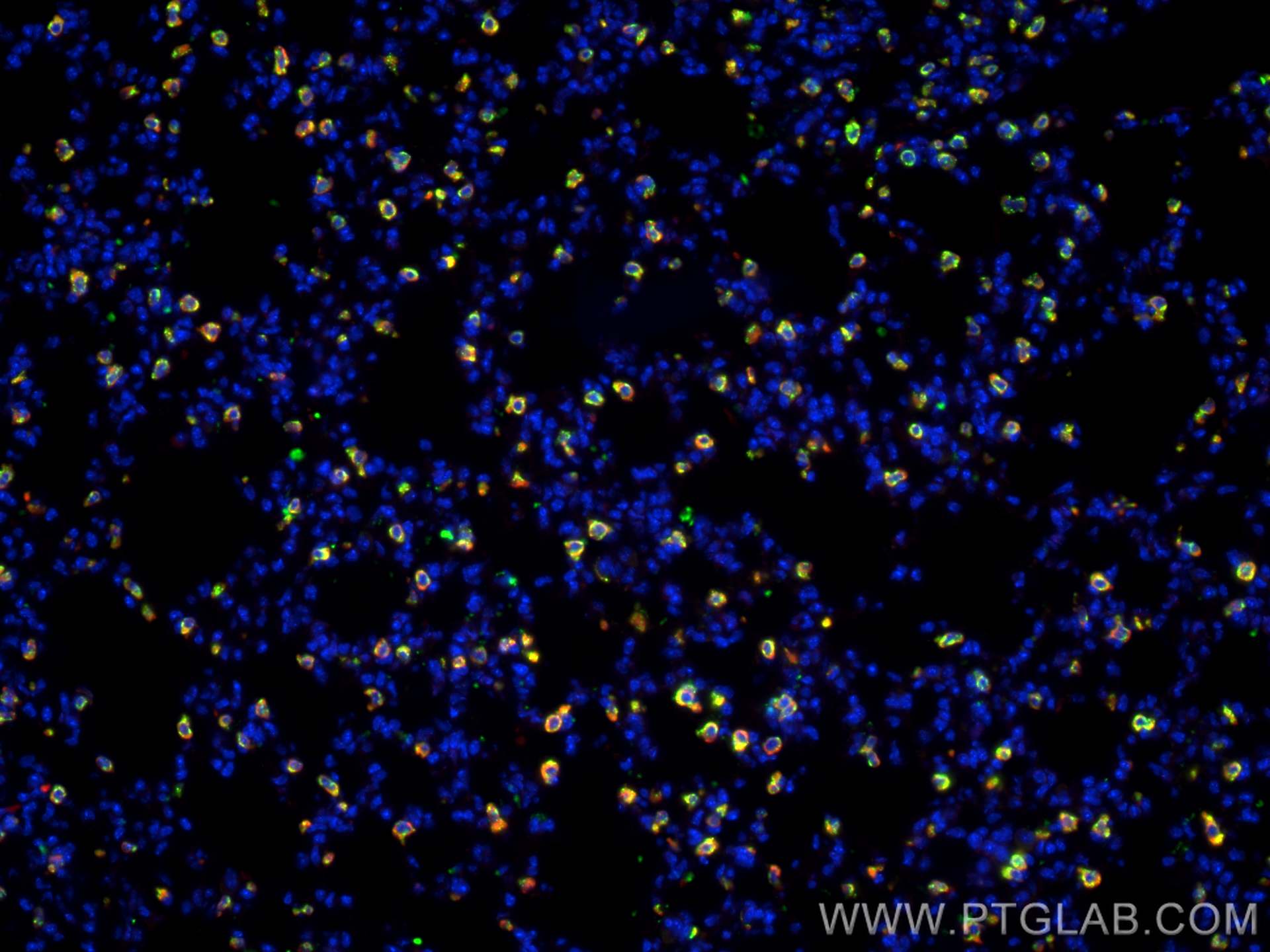 IF Staining of mouse lung using 66044-1-Ig (same clone as 66044-1-PBS)