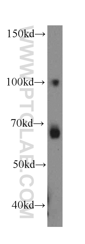 WB analysis of HT-1080 using 19545-1-AP