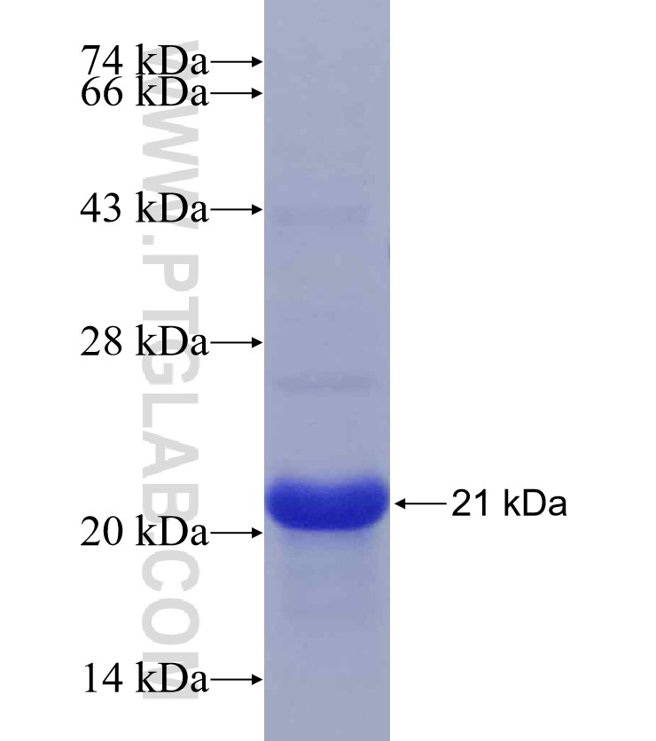 LPL fusion protein Ag29650 SDS-PAGE