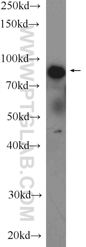 WB analysis of human saliva using 10376-1-AP