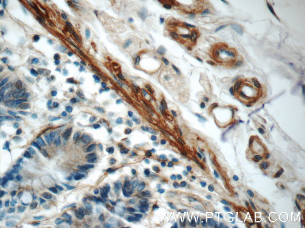 IHC staining of human small intestine using 25045-1-AP