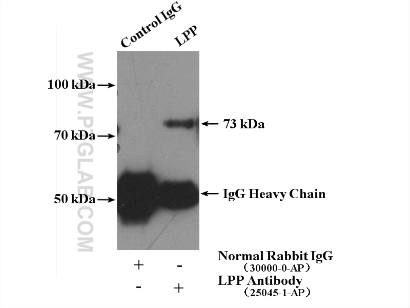 IP experiment of HeLa using 25045-1-AP