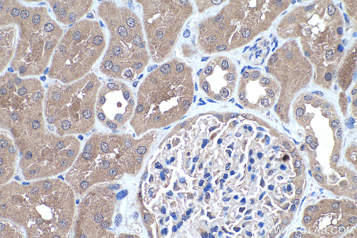 IHC staining of human kidney using 25732-1-AP