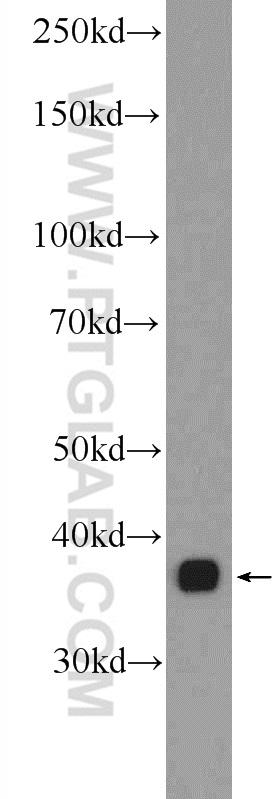 WB analysis of 3T3-L1 using 25732-1-AP