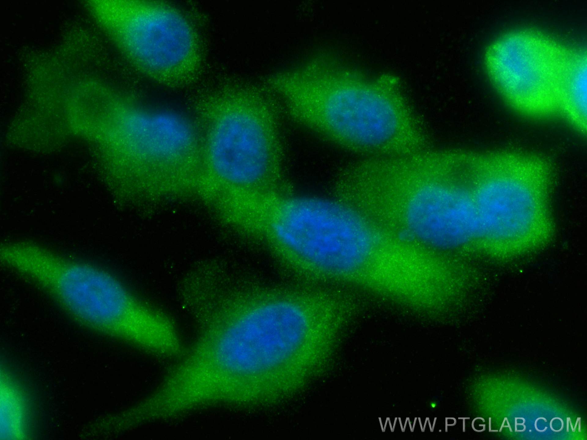 IF Staining of PC-3 using 11307-1-AP