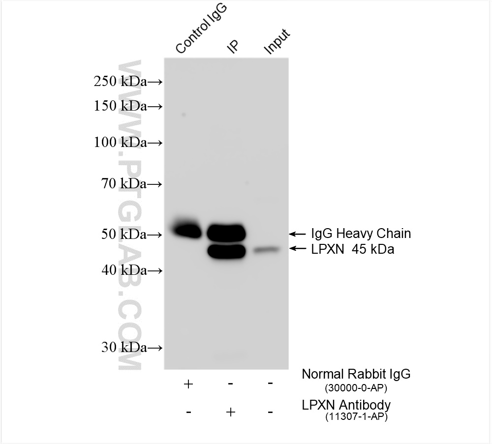 IP experiment of PC-3 using 11307-1-AP