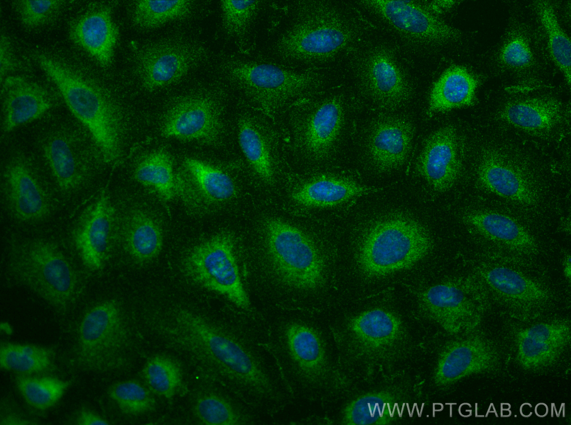 IF Staining of A549 using 31231-1-AP