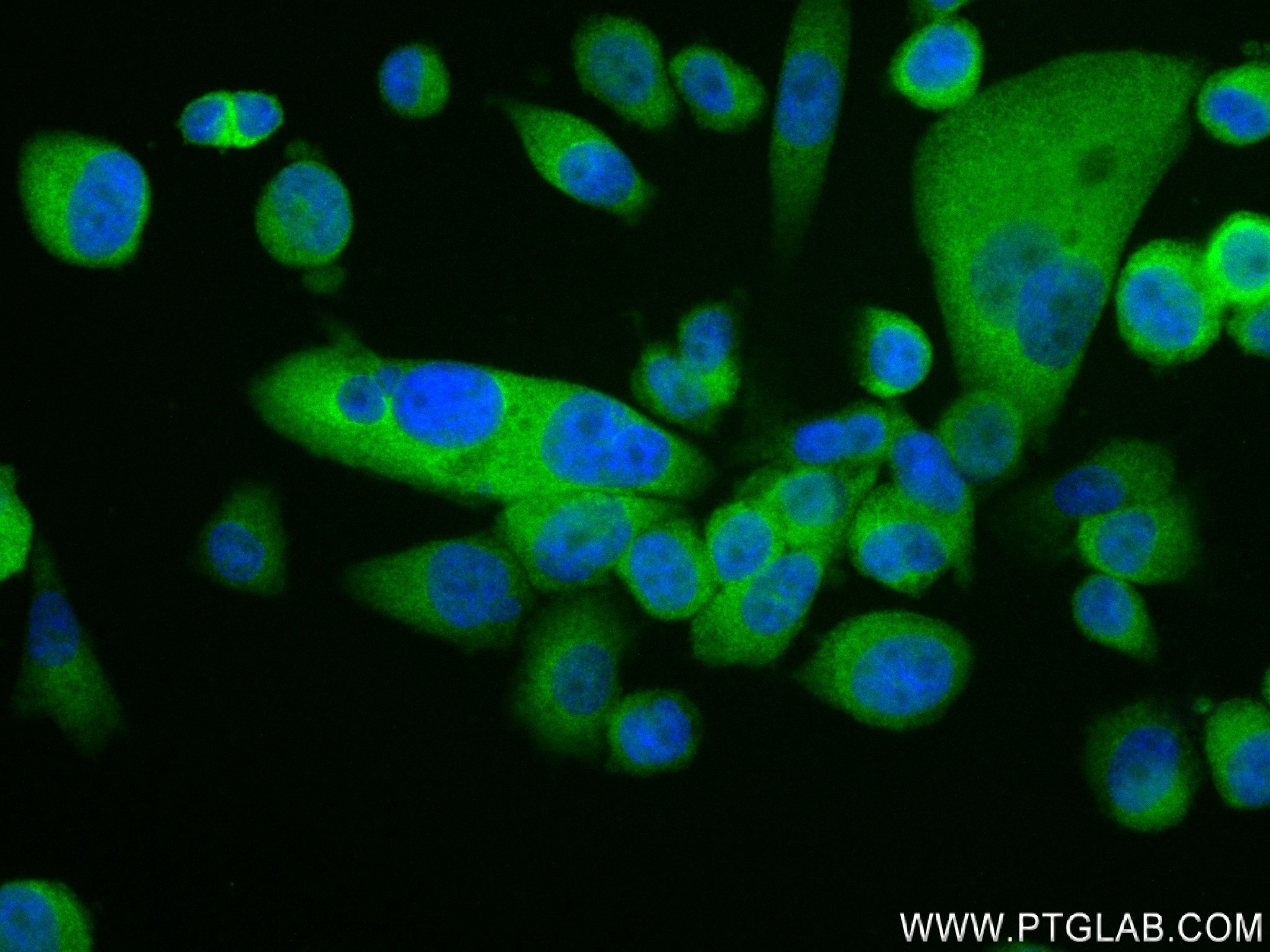 IF Staining of PC-3 using 83657-5-RR (same clone as 83657-5-PBS)