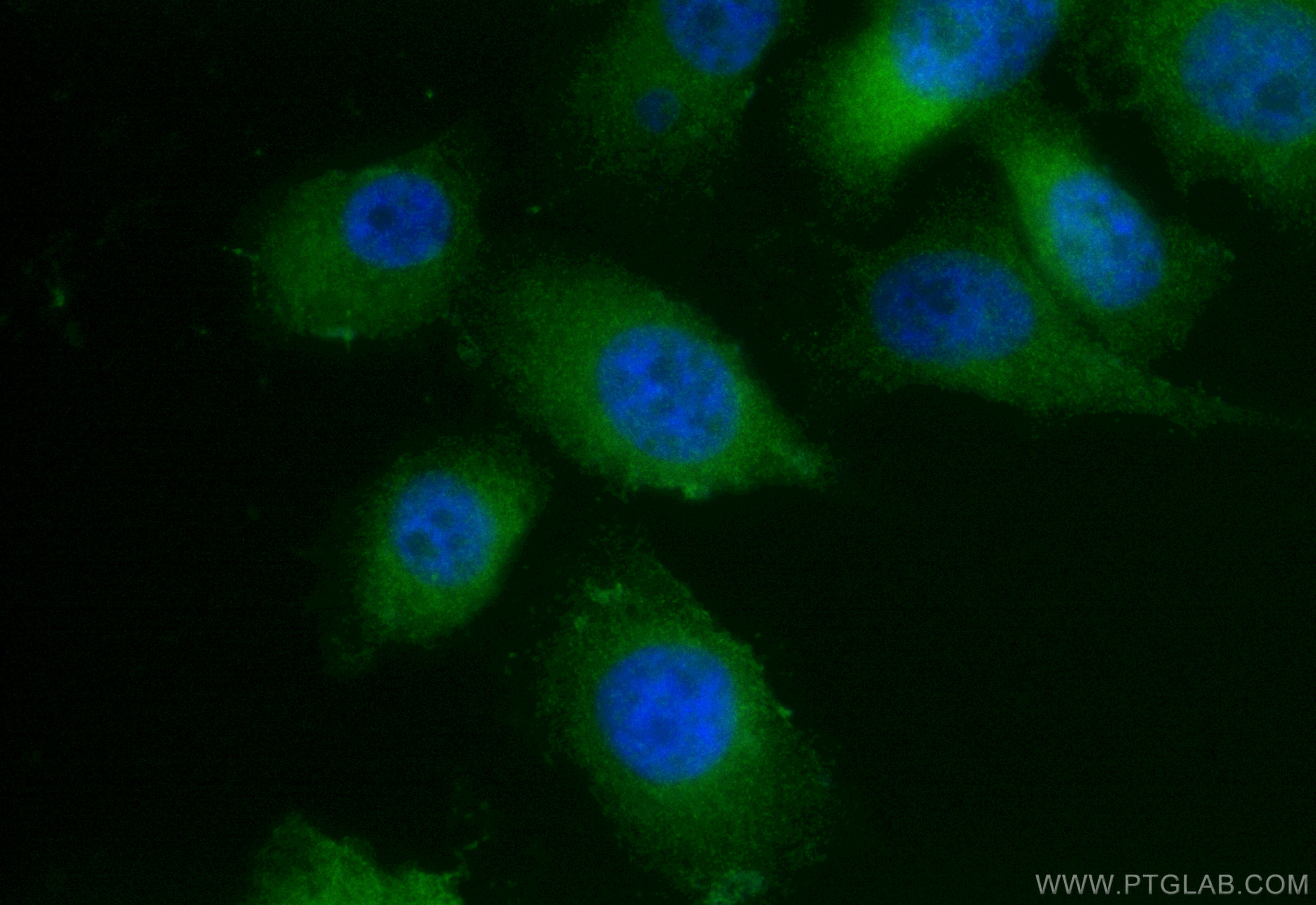 IF Staining of PC-3 using CL488-83657-5