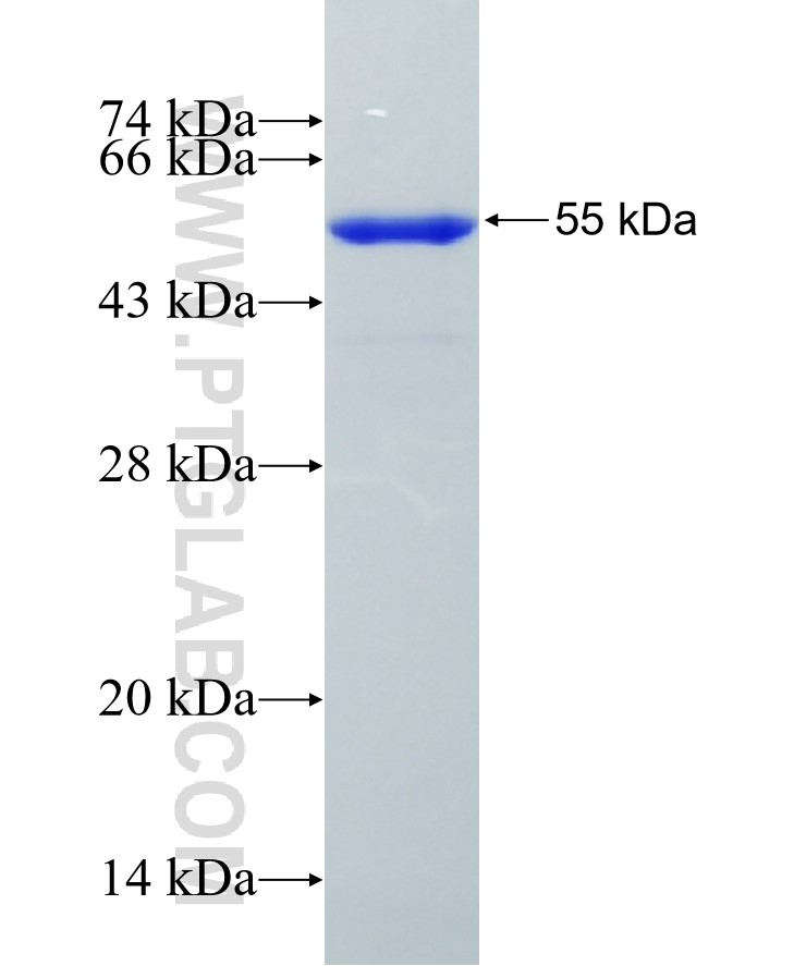 LPXN fusion protein Ag34956 SDS-PAGE