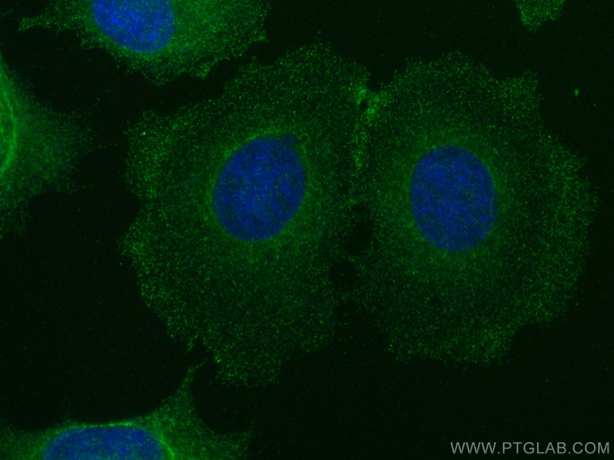 IF Staining of MCF-7 using 25017-1-AP