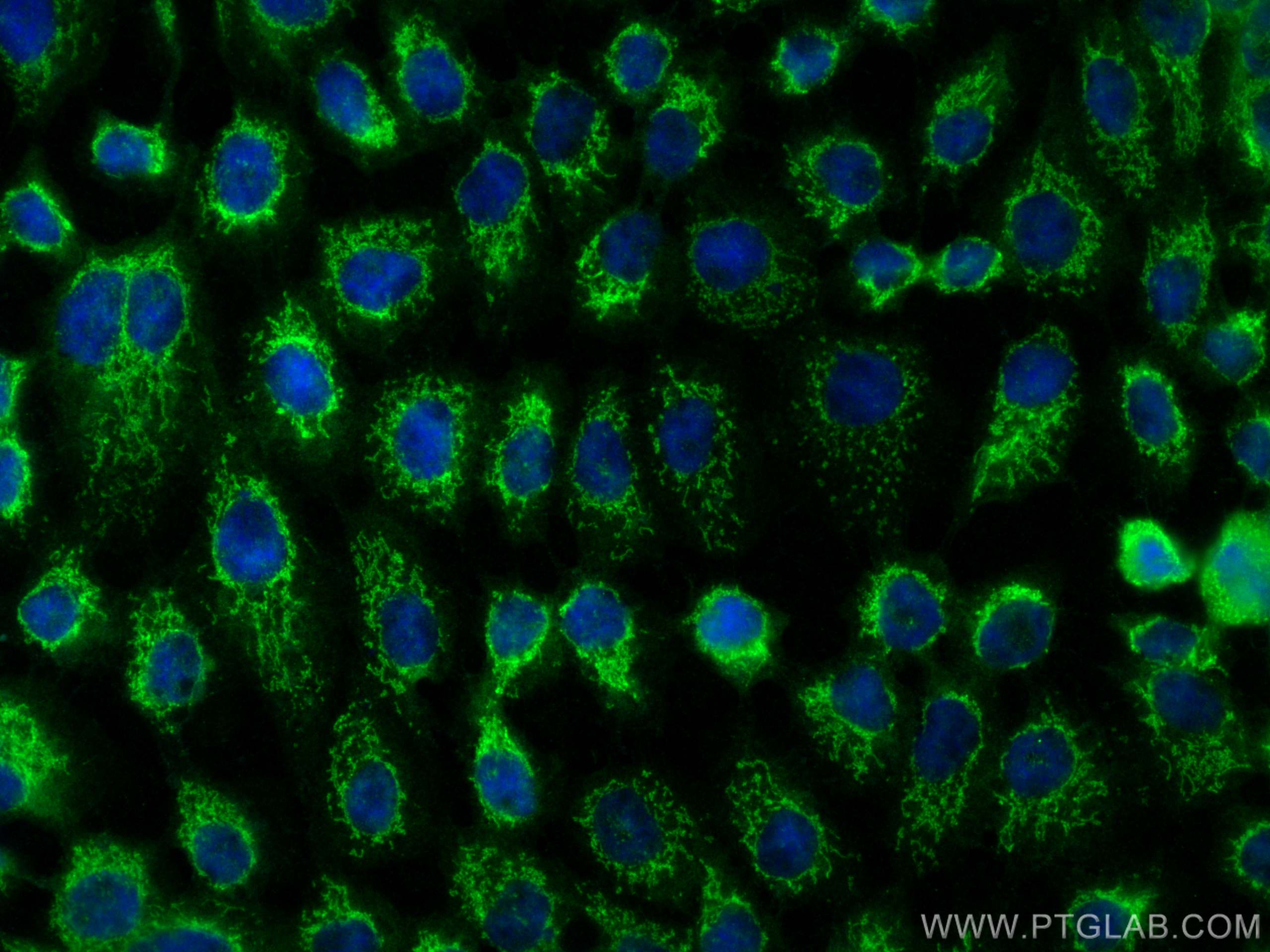 IF Staining of A431 using 15800-1-AP