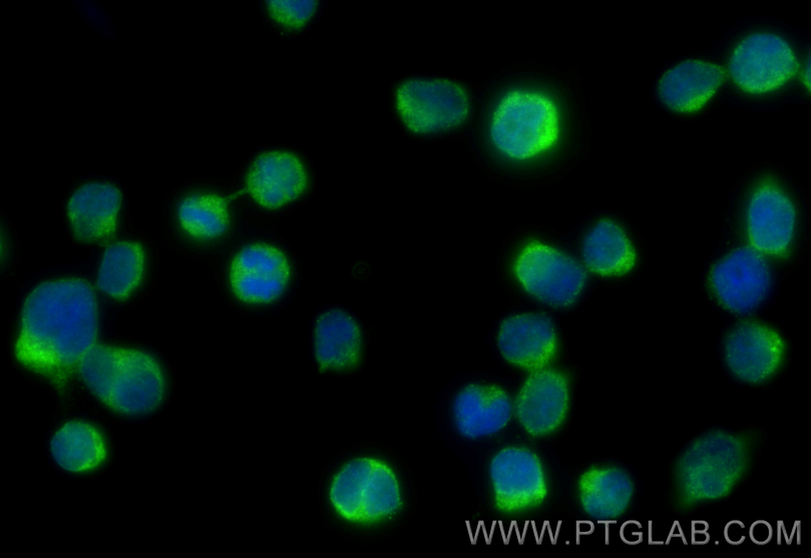 IF Staining of Jurkat using 19498-1-AP