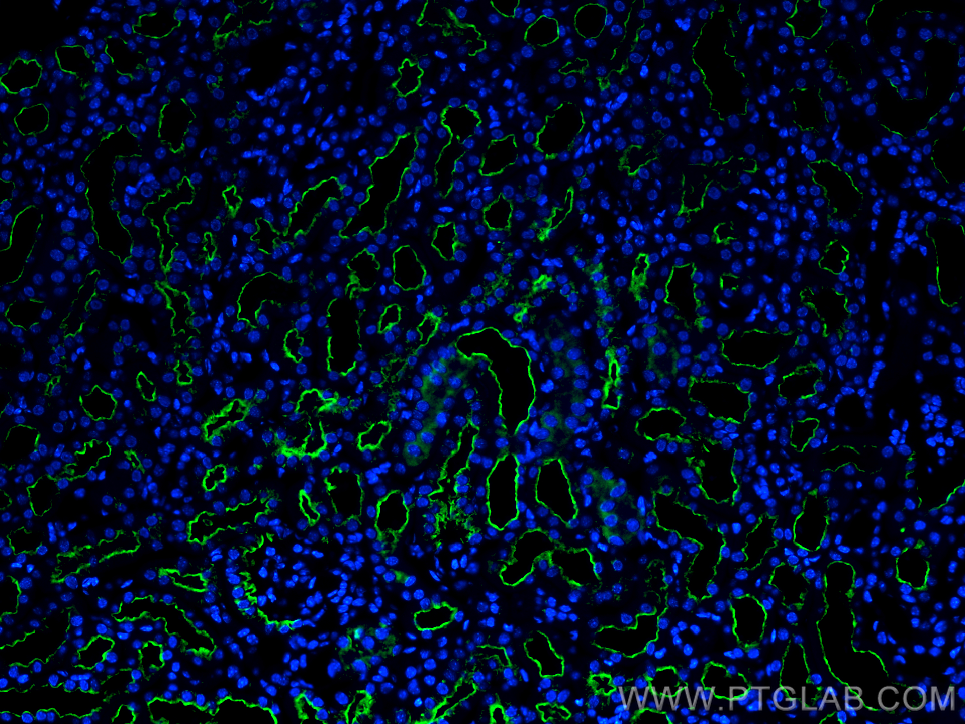 IF Staining of mouse kidney using CL488-19700