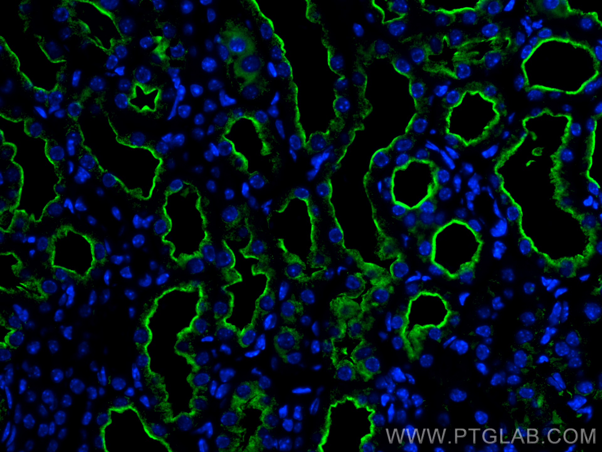 IF Staining of mouse kidney using CL488-19700