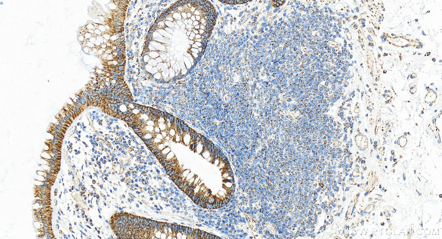 IHC staining of human normal colon using 21175-1-AP