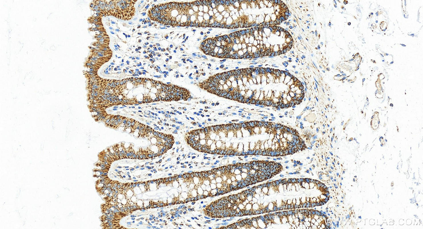 IHC staining of human normal colon using 21175-1-AP