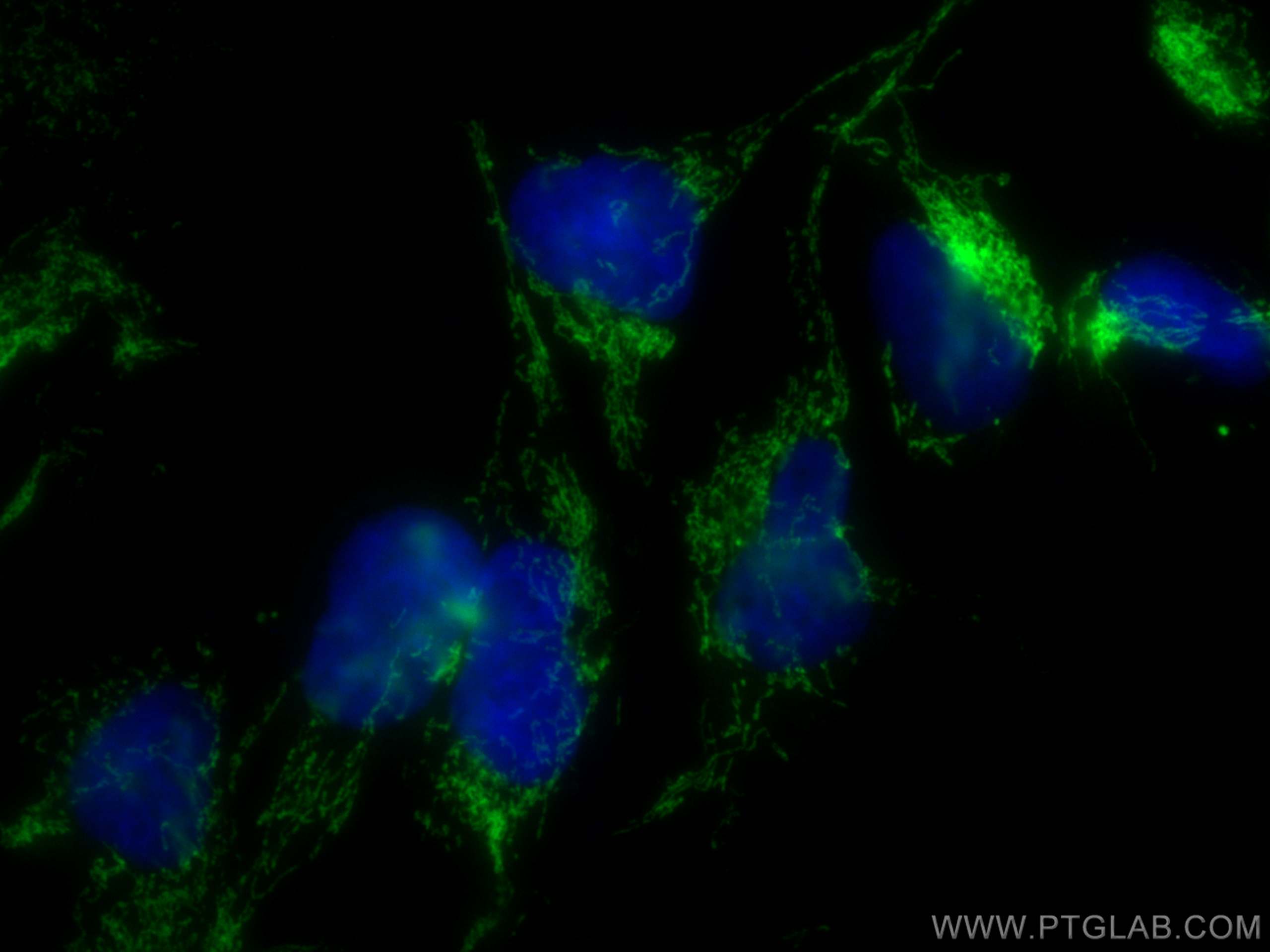 IF Staining of HEK-293 using 21175-1-AP