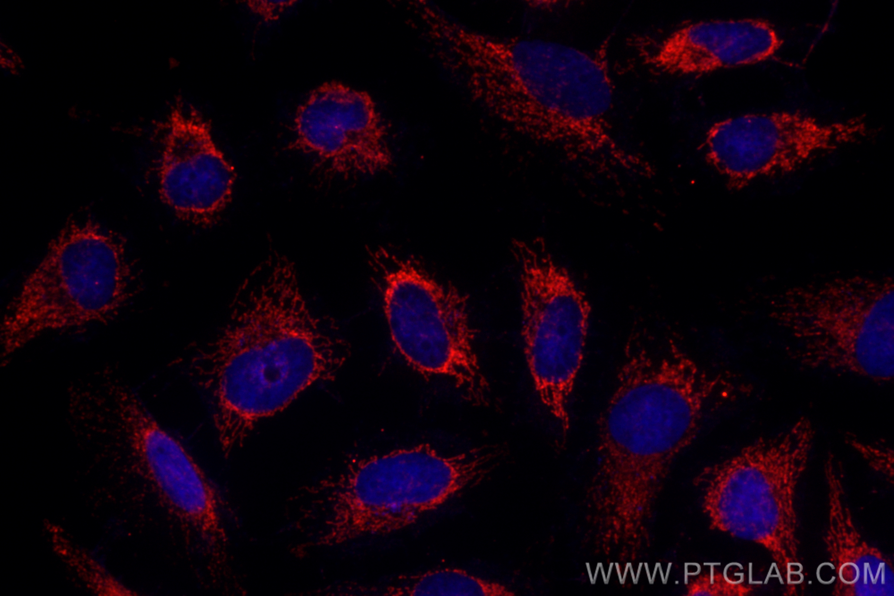 IF Staining of HeLa using CL594-67679