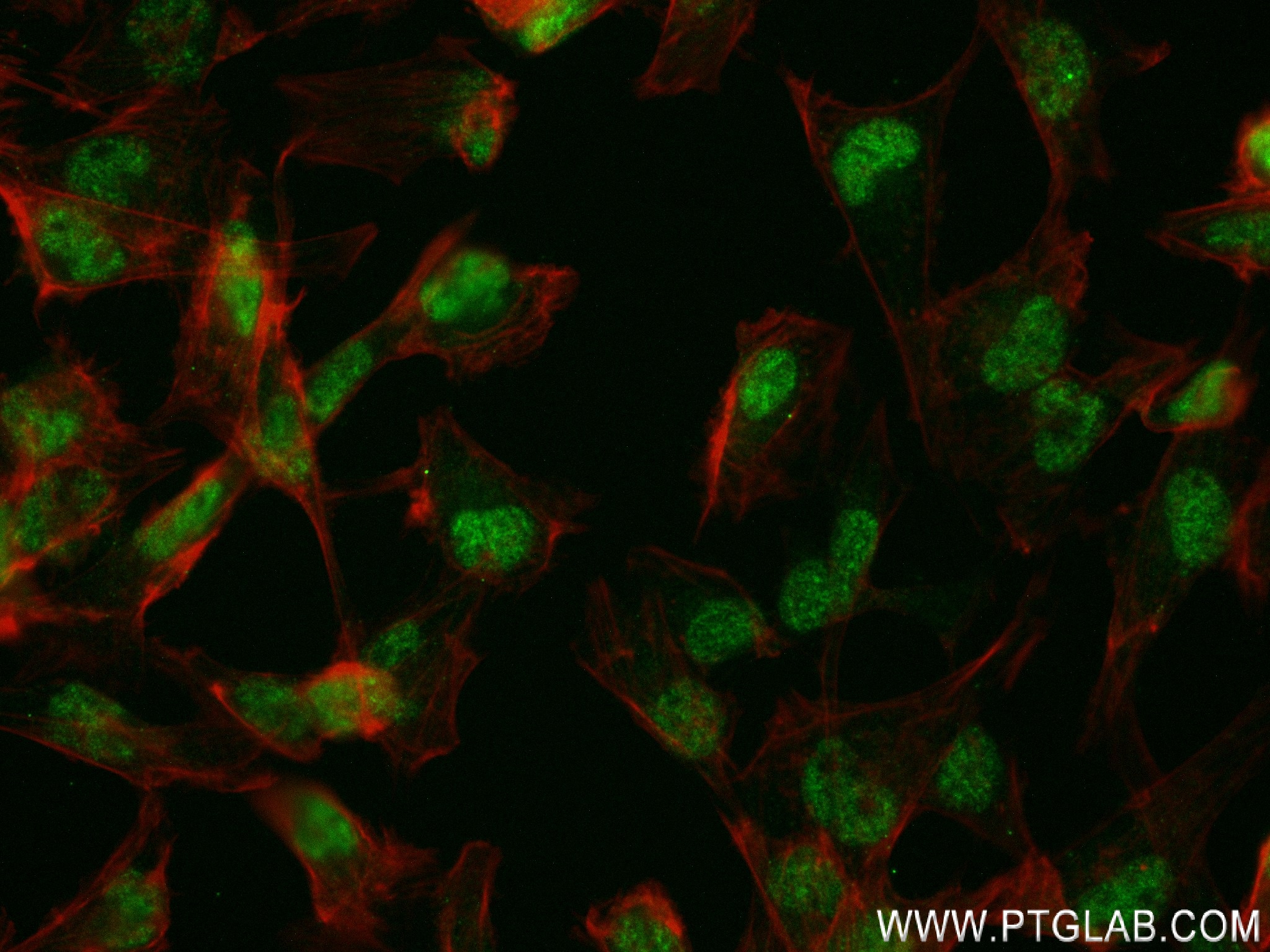 IF Staining of U-251 using 84404-1-RR (same clone as 84404-1-PBS)