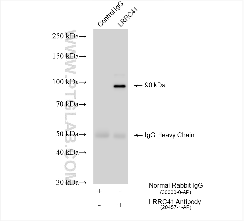 IP experiment of K-562 using 20457-1-AP