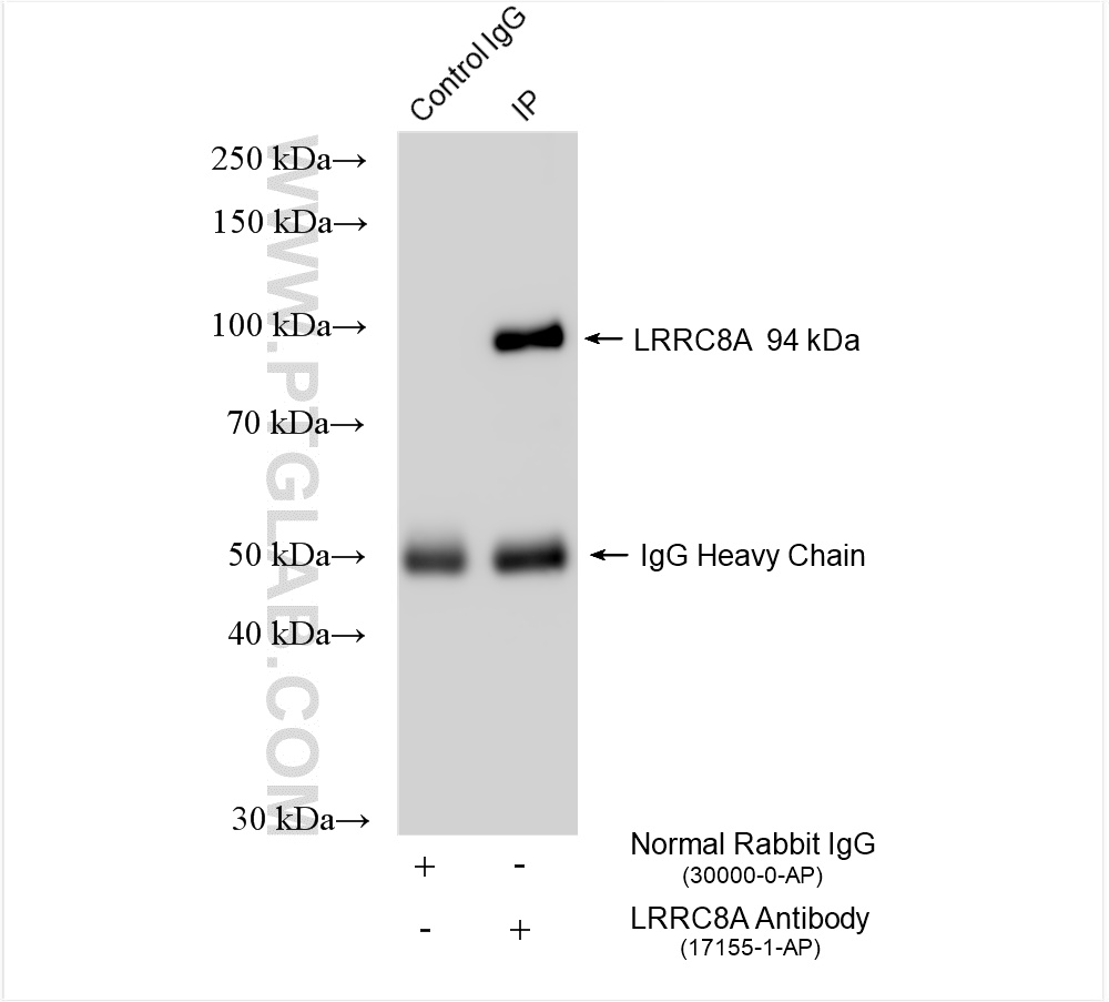 IP experiment of mouse brain using 17155-1-AP