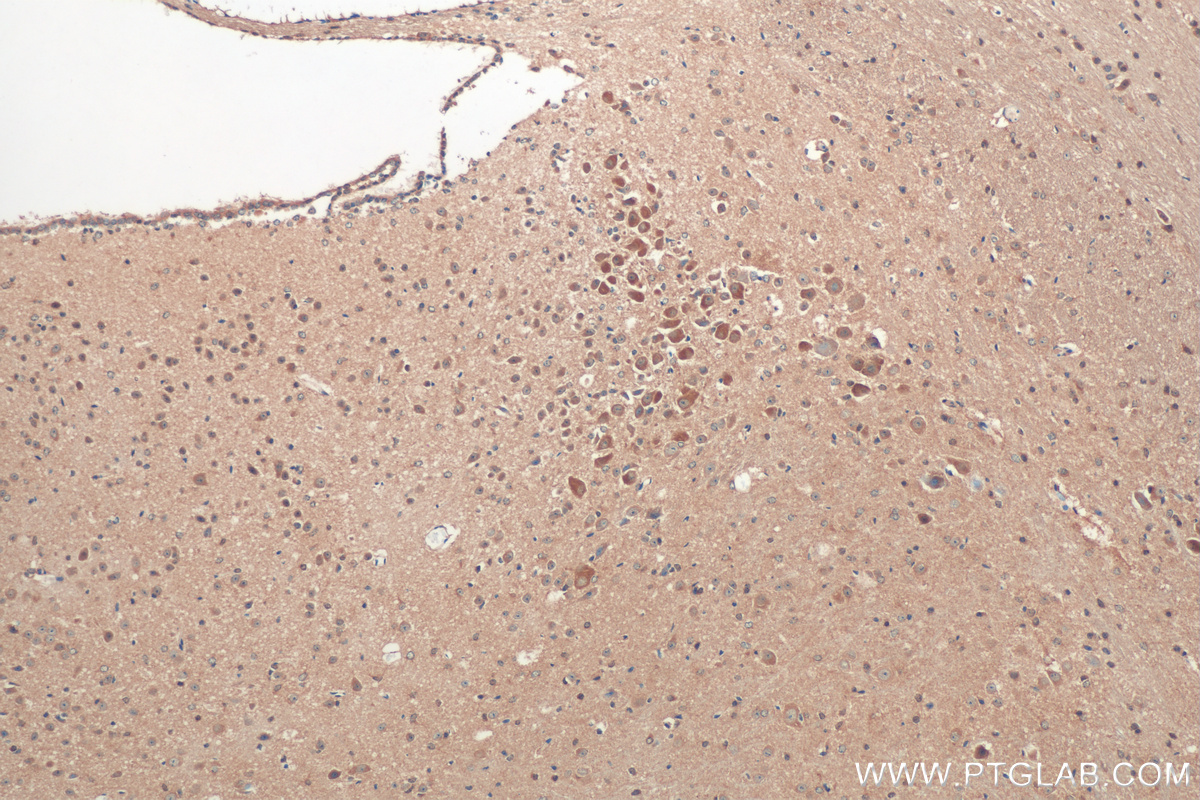 IHC staining of mouse cerebellum using 26317-1-AP