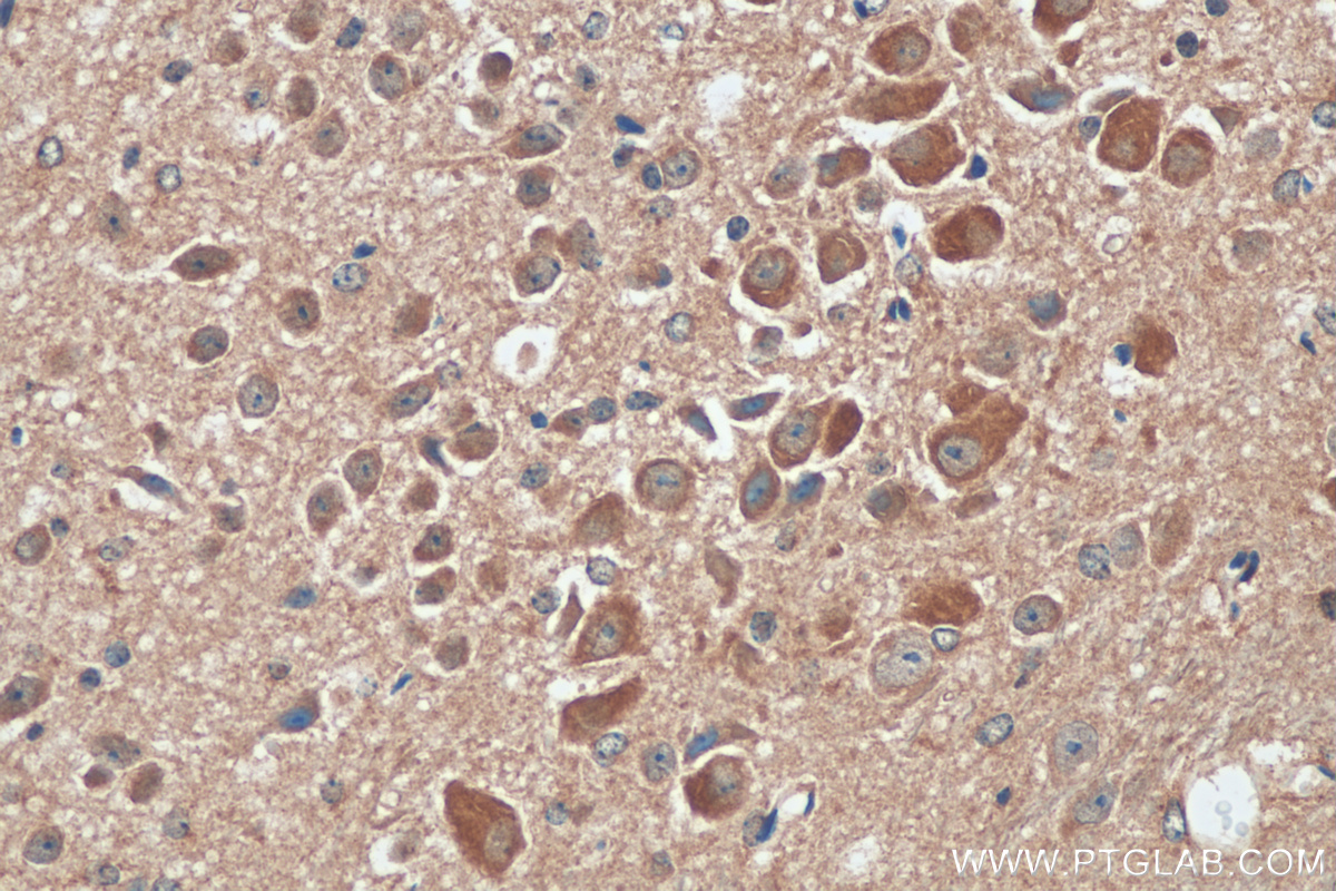 IHC staining of mouse cerebellum using 26317-1-AP