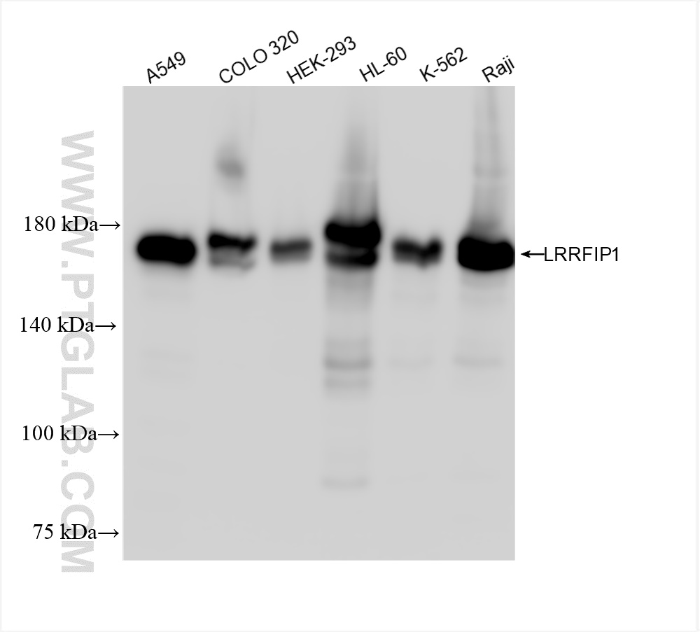 WB analysis using 84778-4-RR