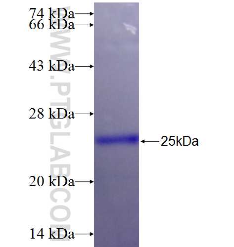 LRRFIP2 fusion protein Ag26374 SDS-PAGE