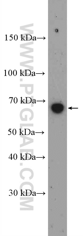 WB analysis of Neuro-2a using 27003-1-AP